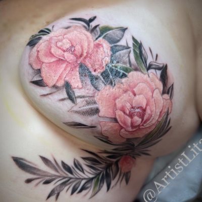 a close-up photo of a tattoo of two roses over a mastectomy scar. The roses are pink and have foliage around them. 